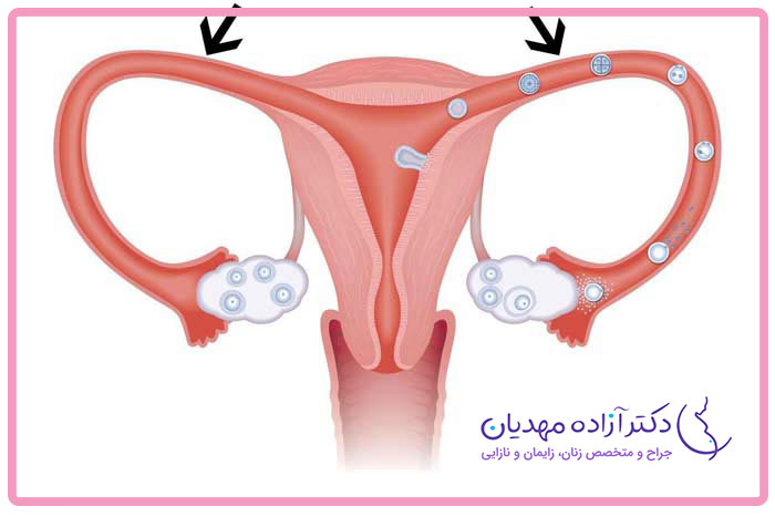 رحم