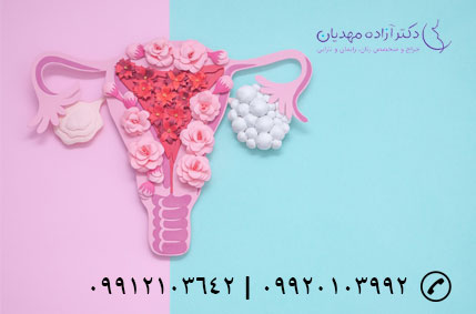 سندرم تخمدان پلی کیستیک
