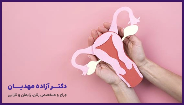 اهمیت تشخیص سریع تنبلی تخمدان
