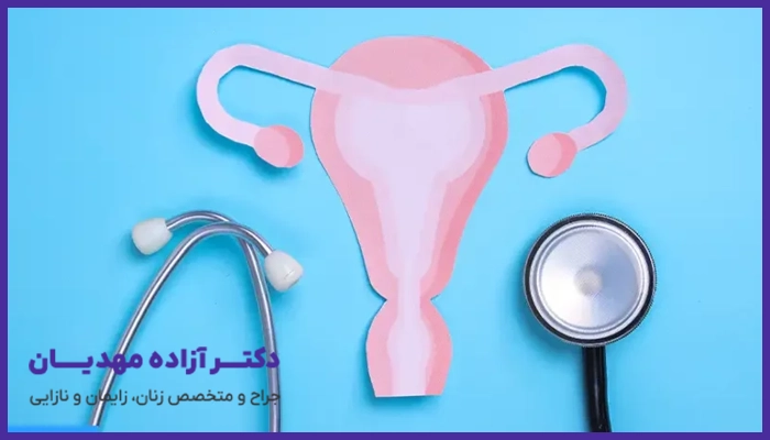 علائم تنبلی تخمدان